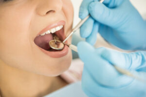 Retracția gingivală: ce este și cum poate fi tratată?